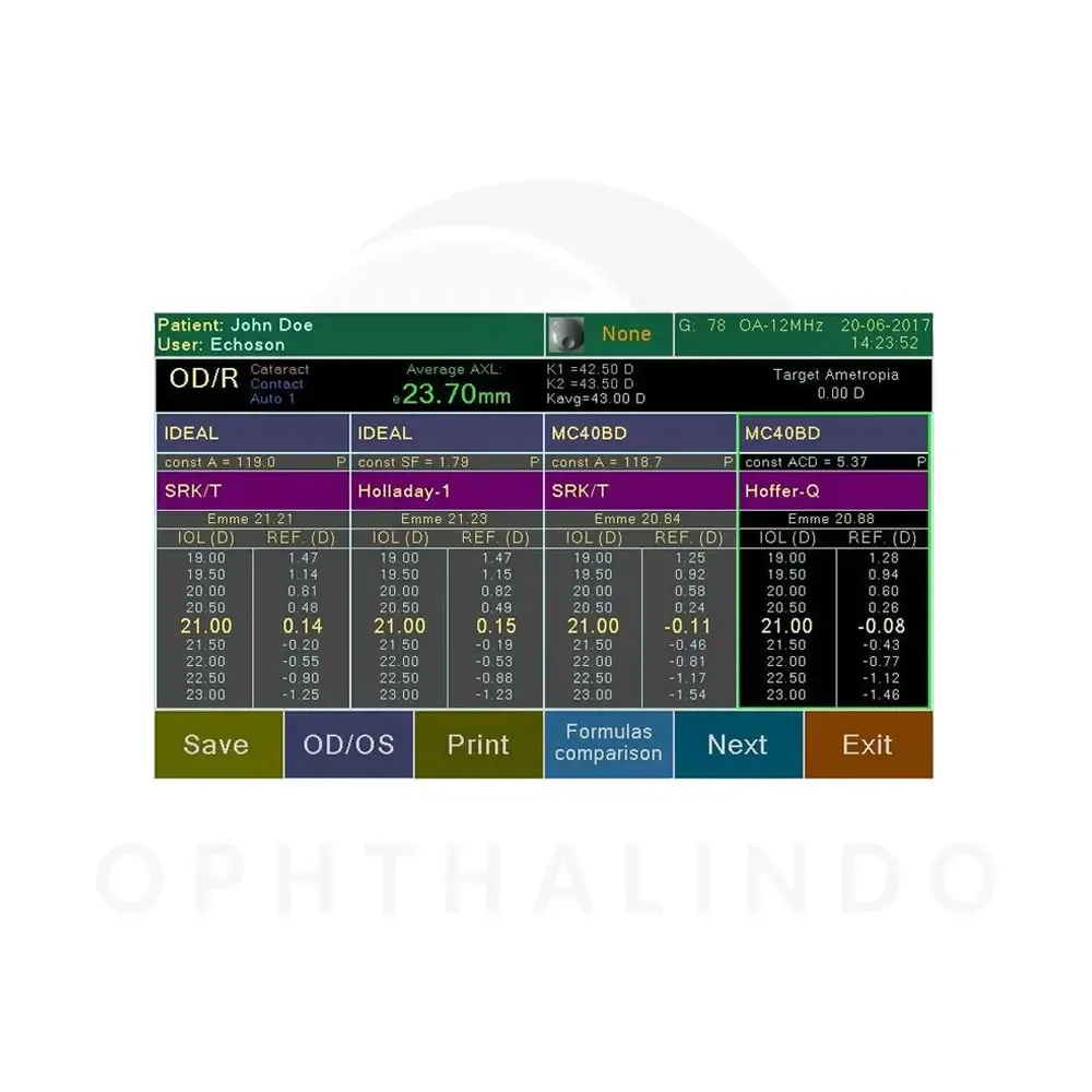 ECHOSON Biometry A-Scan — view 4