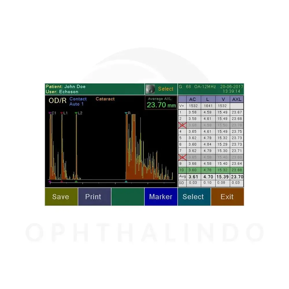ECHOSON Biometry A-Scan — view 3