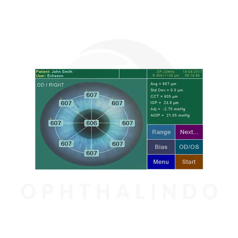 ECHOSON Pachymetry Scanner — view 3