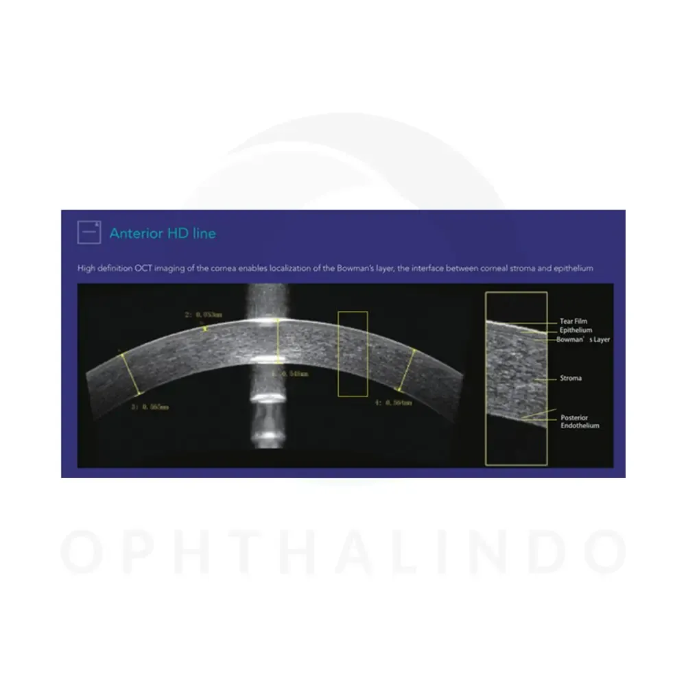 MOPTIM Mocean 4000 OCT — view 4