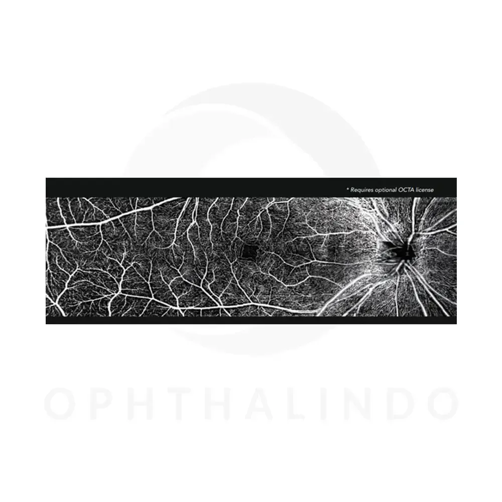 MOPTIM Mocean 4000 OCT — view 5