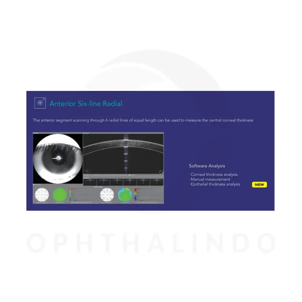 MOPTIM Mocean 4000 OCT — view 6