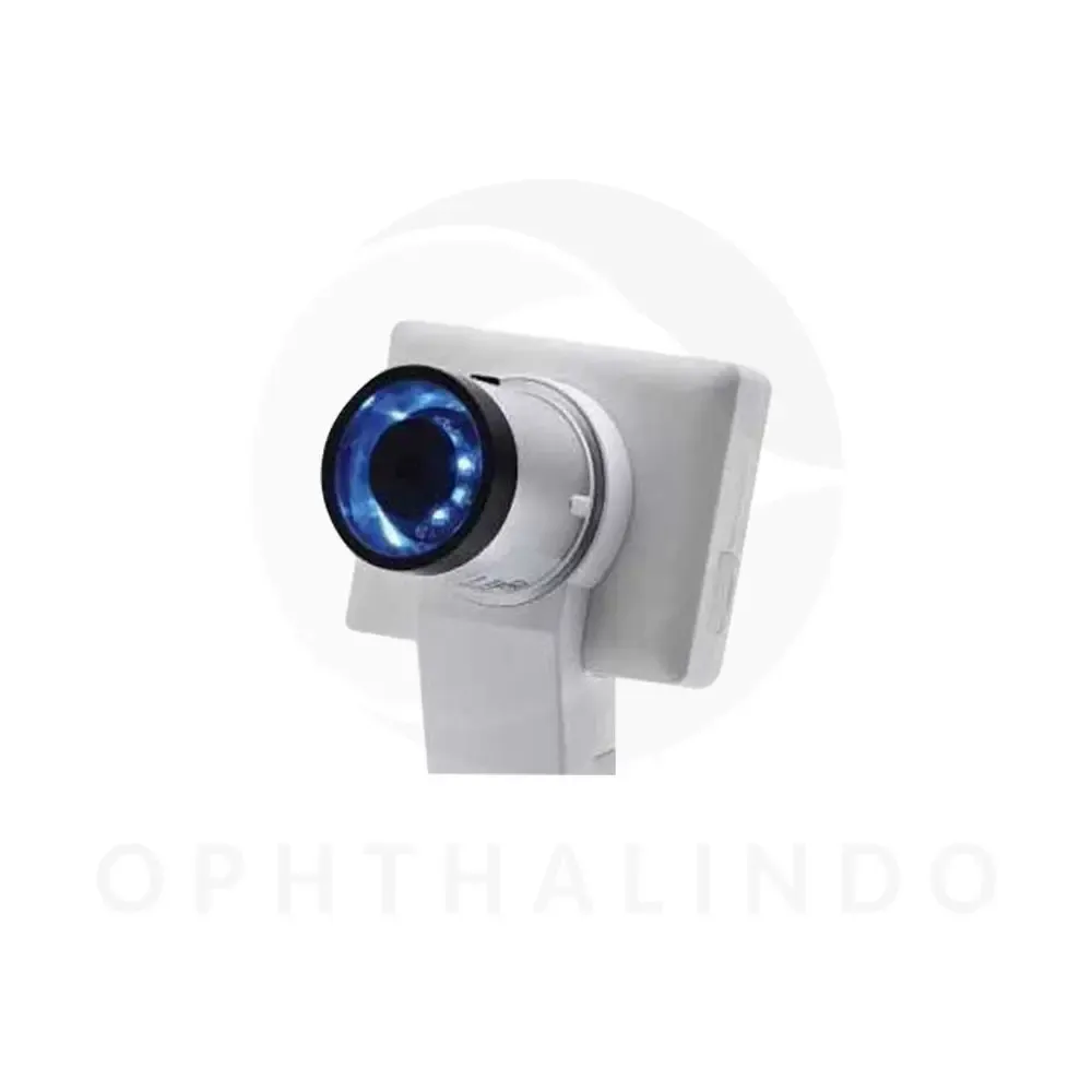 Miss Fundus Camera 3 in 1 — view 4
