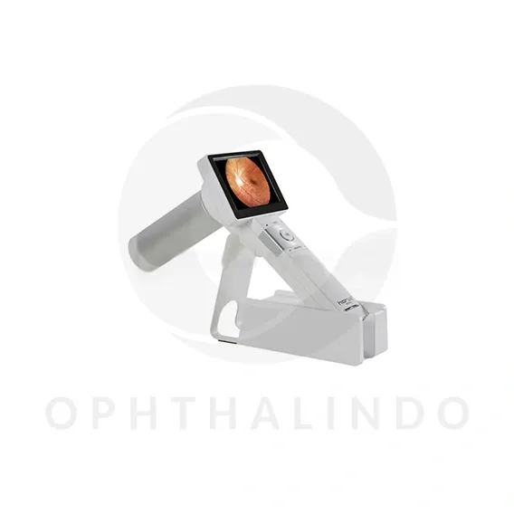 Miis Portable Fundus Dec 200 — view 3