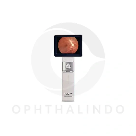 Miis Portable Fundus Dec 200 — view 2